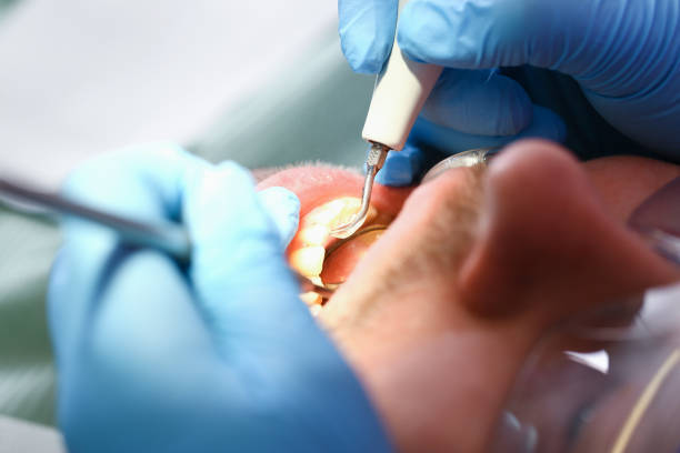 Best Urgent Dental Care for Toothache in Georgetown, TX