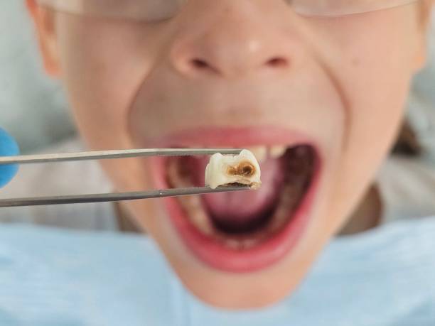 Best Emergency Dentist for Special Needs Patients in Georgetown, TX