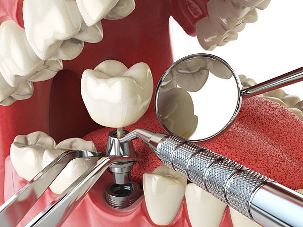 Best Weekend Emergency Dentist in Georgetown, TX
